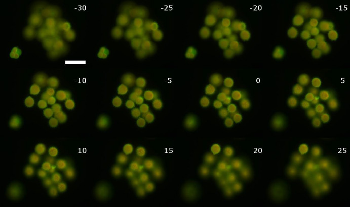 通過一組花粉粒進行基于 ETL 的聚焦